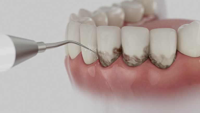 Reliable Tooth Extraction contractor in Firebaugh, CA by Smile Center Dentistry